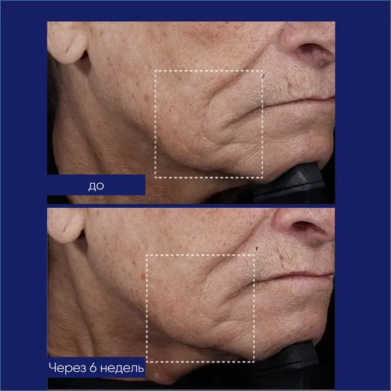 Увлажняющий крем для лифтинга и скульптурирования лица