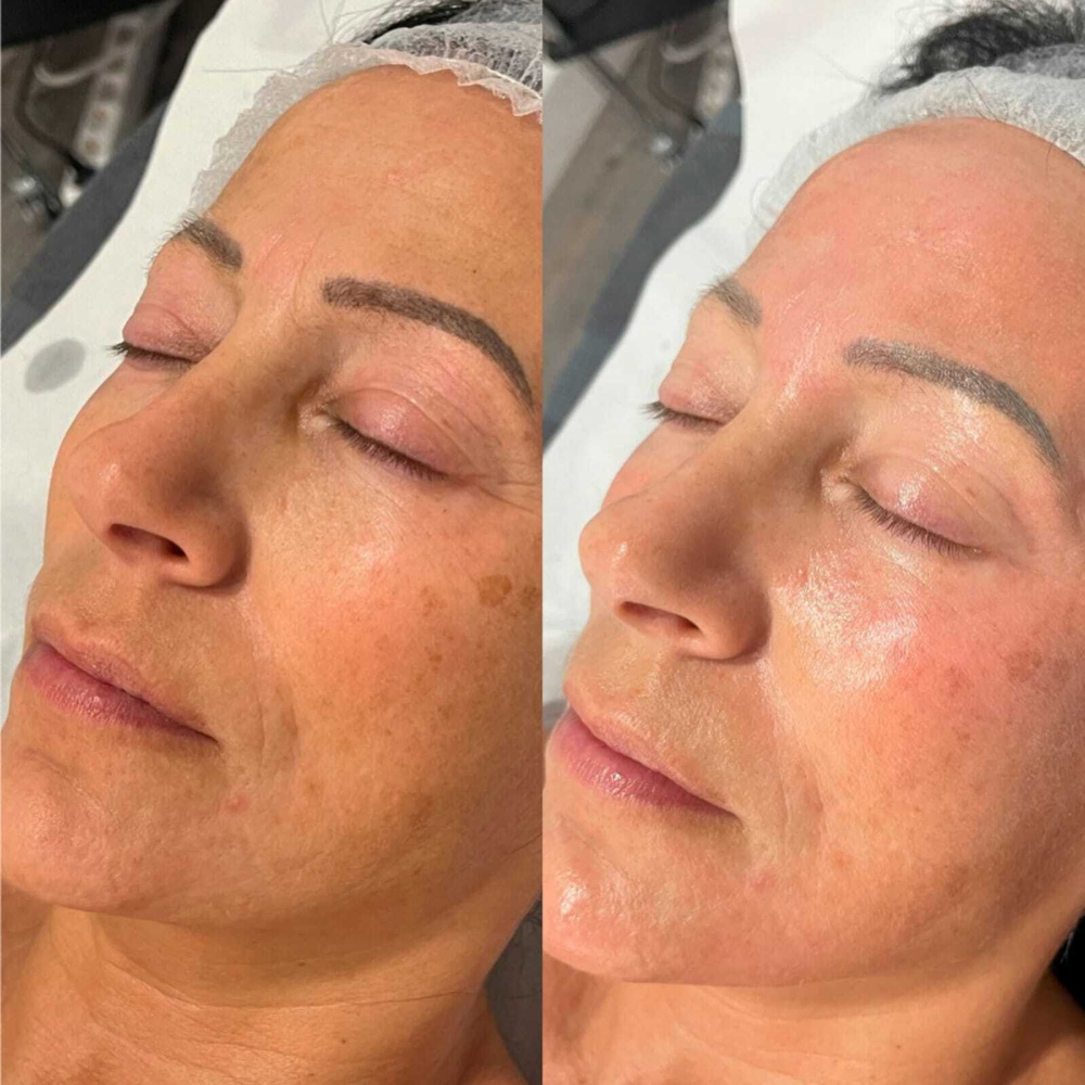 Rejusome | Сыворотка для омоложения кожи лица с экзосомами