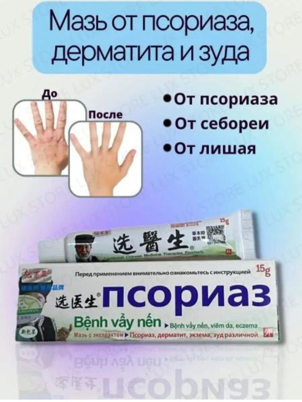 Мазь от псориаза, дерматита и зуда