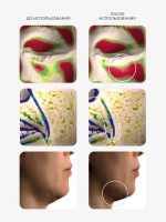 Arocell Мощная пузырьковая сыворотка с низкомолекулярным коллагеном Super Collagen Booster Serum 30 мл