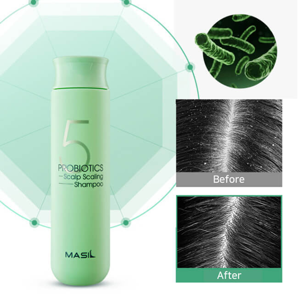 Masil 5 Probiotics Scalp Scaling Shampoo 150ml