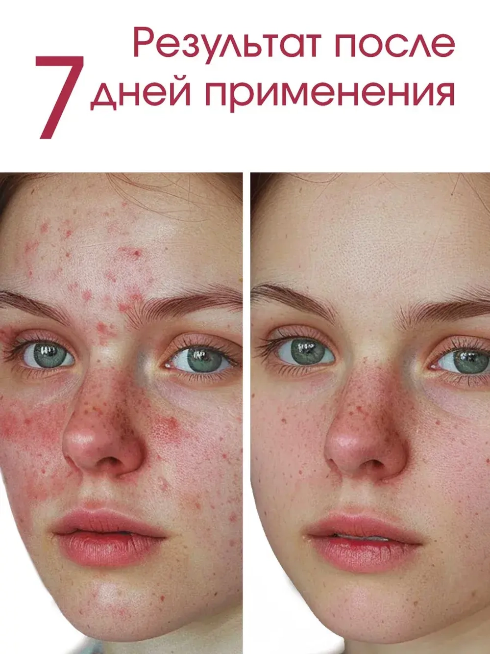 Корейский тонер для лица успокаивающий HEARTLEAF 77%