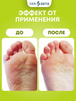 Увлажняющие гелевые носки «5 пальцев»