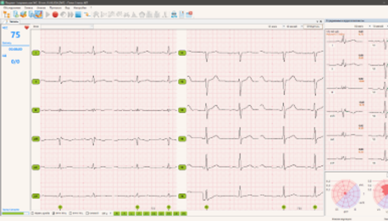 ПОЛИ-СПЕКТР-8/Е