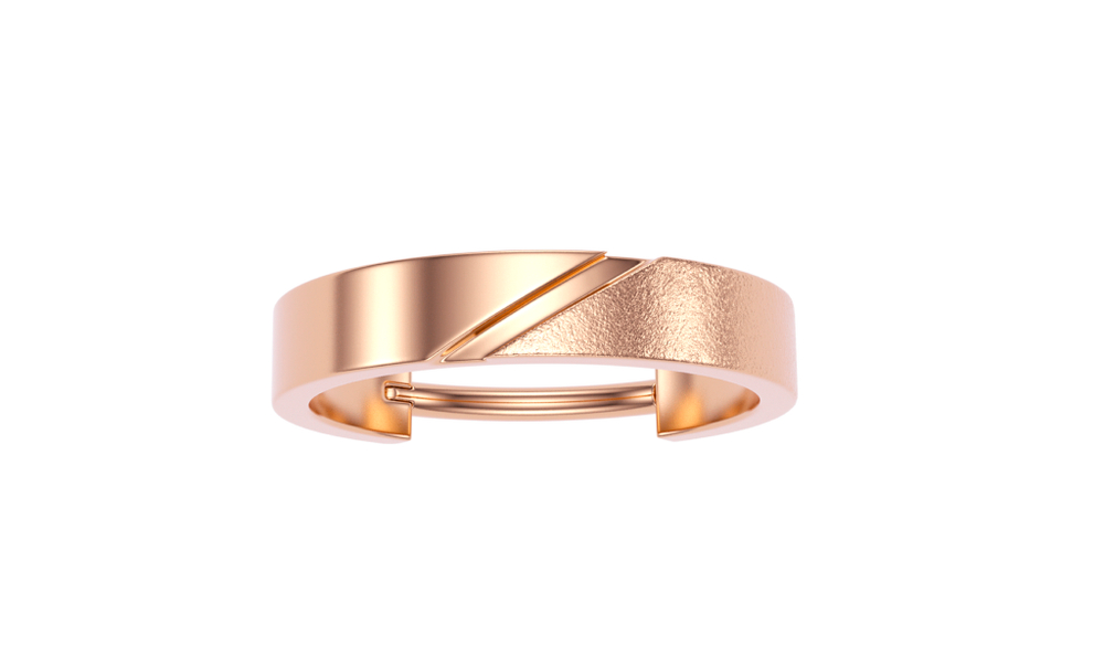 Volar ring