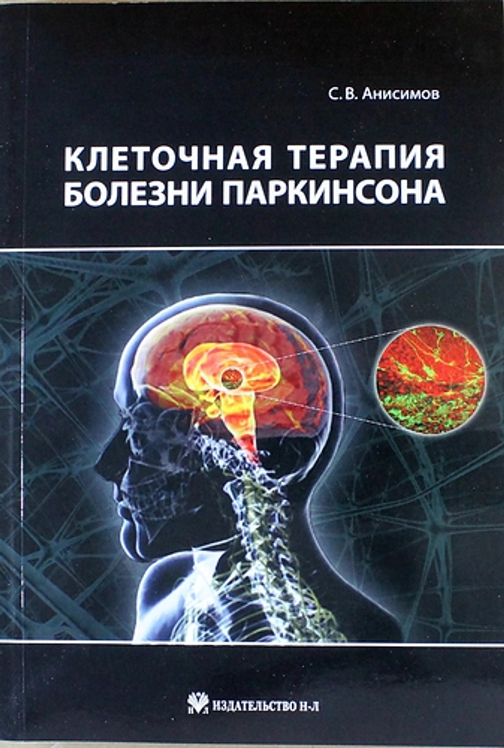Клеточная терапия болезни Паркинсона