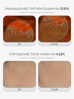 Medicube Успокаивающий тонер с ПДРН и комплексом пептидов PDRN Pink CICA Soothing Toner 250 мл