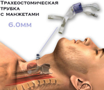 Трахеостомическая трубка с манжетами, 6.0мм