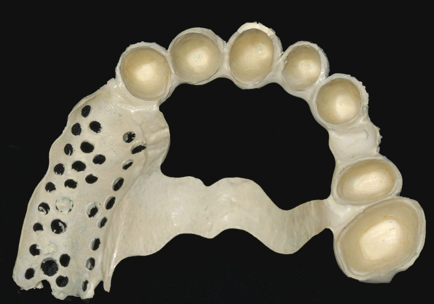 Разговоры о низкой ремонтопригодности протезов