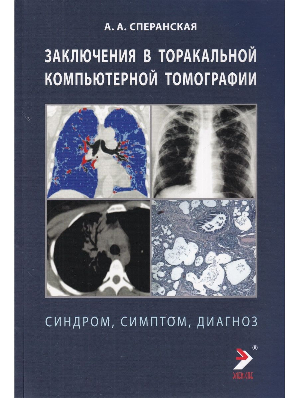 Заключение в торакальной компьютерной томографии. Симптом, синдром, диагноз