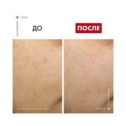 Vichy Liftactiv B3 Tone Correcting Ночной крем для лица с ретинолом против пигментации и морщин, 50 мл