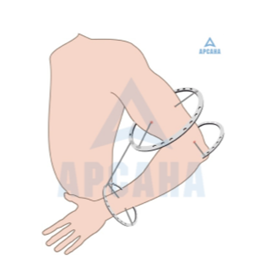 Чехлы на гипс / лангет, стопу 