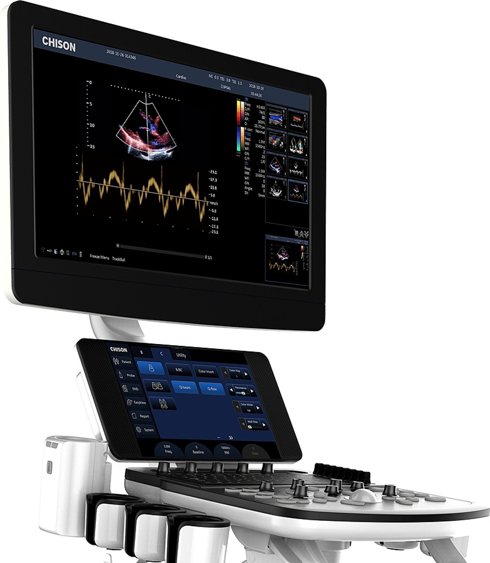 Ультразвуковой сканер Chison Qbit 8