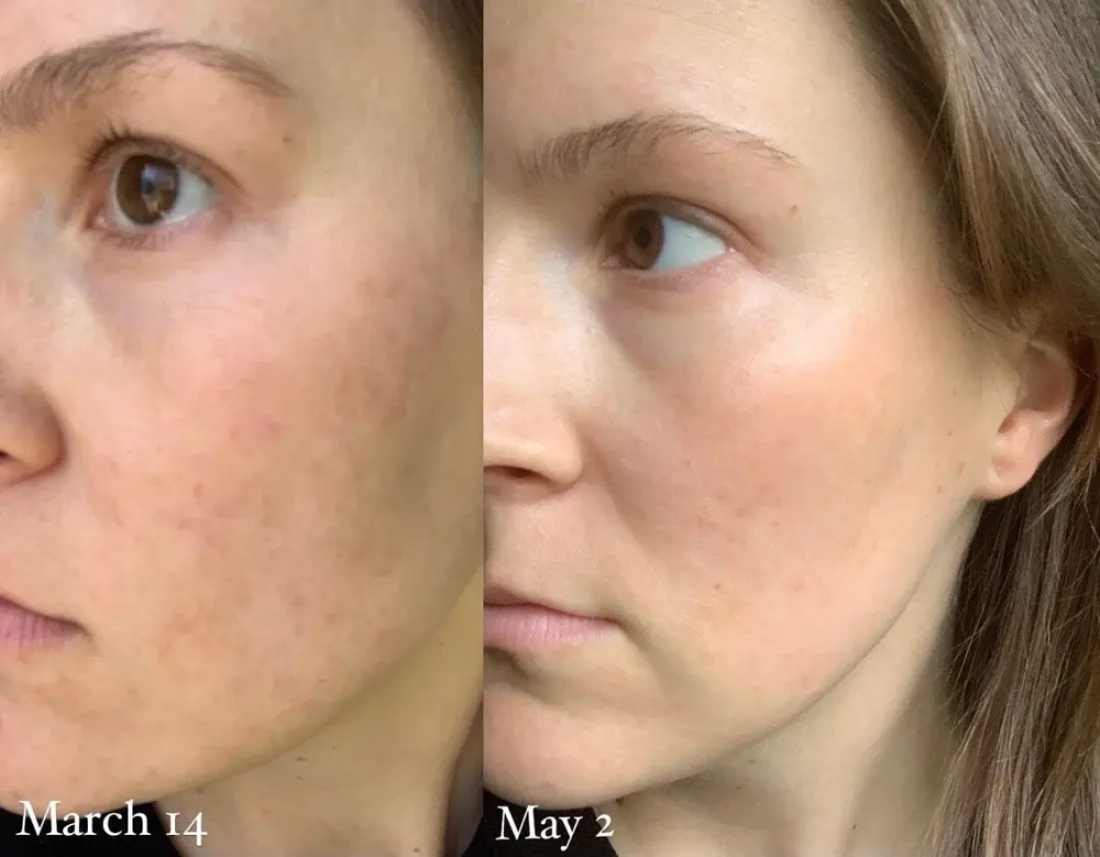 Сыворотка Holifrog Sunnyside C Glow Serum 30 мл