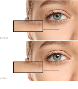 Saffee Advanced Hyaluronic Acid Ampoules - ампулы - 7-дневная интенсивная терапия с гиалуроновой кислотой /   7x2  ml  / GTIN 3760275382887