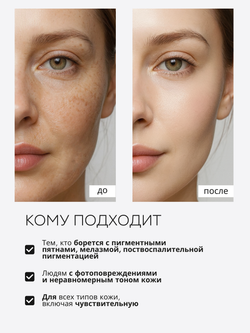 СЫВОРОТКА ОТ ГИПЕРПИГМЕНТАЦИИ