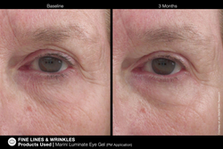 JAN MARINI Luminate Eye Gel Концентрированная сыворотка для кожи вокруг глаз с эффектом сияния против темных кругов и морщин, 15 мл