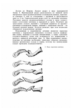 Атлас операций при травмах опорно-двигательного аппарата | Т.А. Ревенко