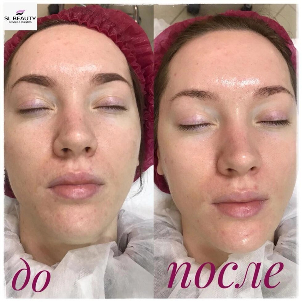Biotime BIOMATRIX PROBIO PEEL биоматрикс пробио пил Всесезонный. Глубоко увлажняющий. Омолаживающий. 30мл