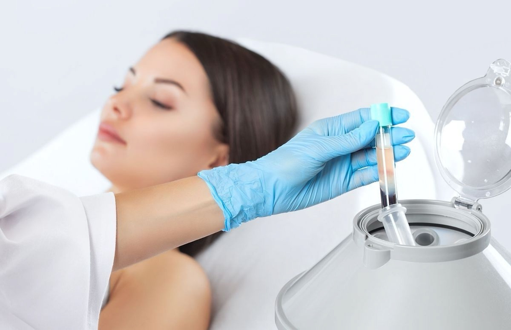 PRP Cortexil 1 пробирка