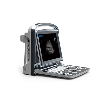 Ультразвуковой аппарат Chison SonoTouch 10