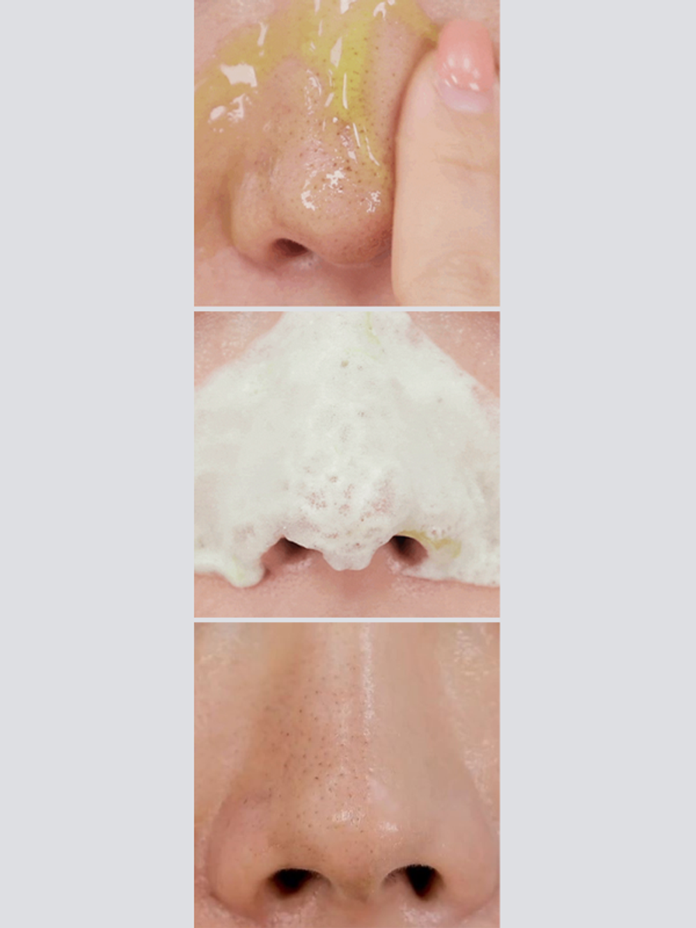 Medi-Peel Кислородная пенка для умывания с кислотами и центеллой Phyto Cica-Nol B5 AHA BHA Vitamin Calming O2 Deep Cleanser 150 мл