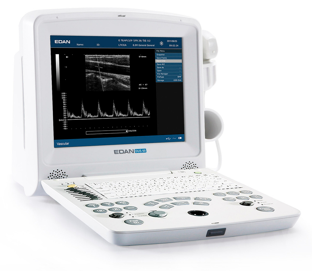 Аппарат УЗИ Edan Dus 60