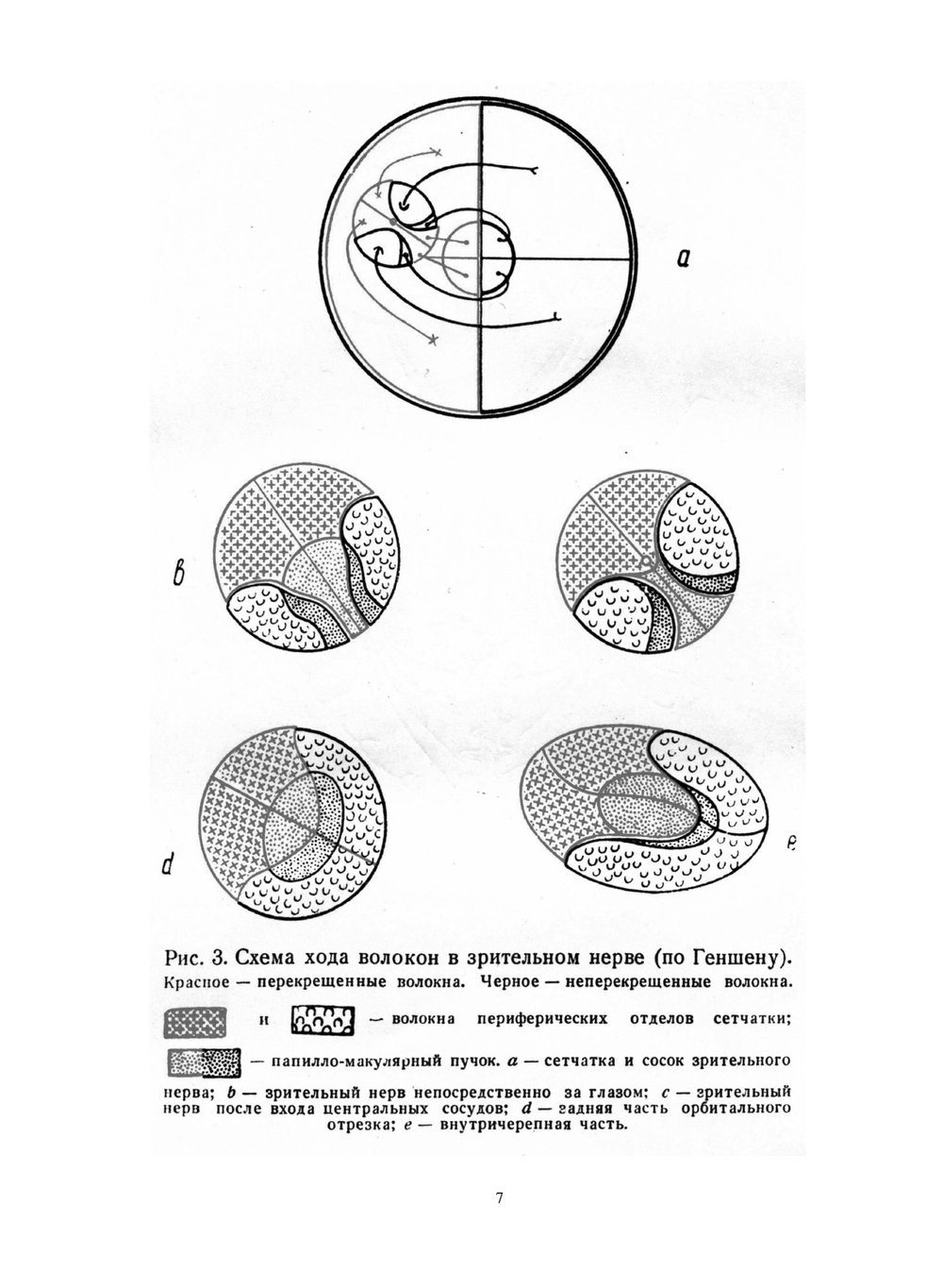 Заболевания зрительного пути | Е.Ж. Трон