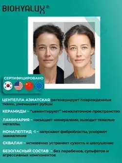 Маска для интенсивного восстановления, защиты и укрепления кожи| BIOHYALUX Barrier Repairing and Restoring Mask, 5 масок