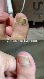 Гель для восстановления ногтей