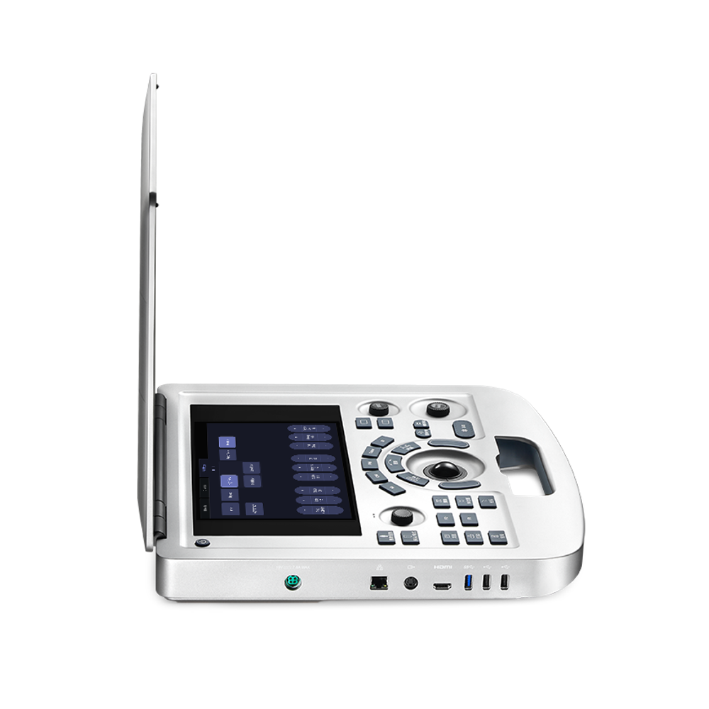 УЗИ аппарат Edan Acclarix AX3