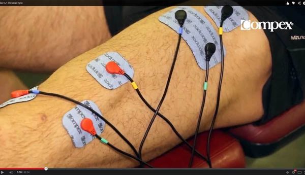 Использование электростимулятора Compex в послеоперационной реабилитации колена
