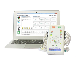 БЕСПРОВОДНОЙ ЭЛЕКТРОКАРДИОГРАФ «КАРДИОМЕТР-МТ» на базе смартфона ОС Андроид и на базе планшета ОС Андроид