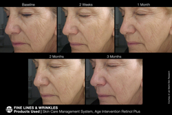 JAN MARINI Age Intervention Retinol Plus MD Крем-акселератор с ретинолом 1% для борьбы с видимыми возрастными изменениями, 28 гр
