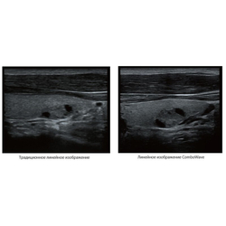 Аппарат УЗИ (сканер) Mindray DC-60 Exp