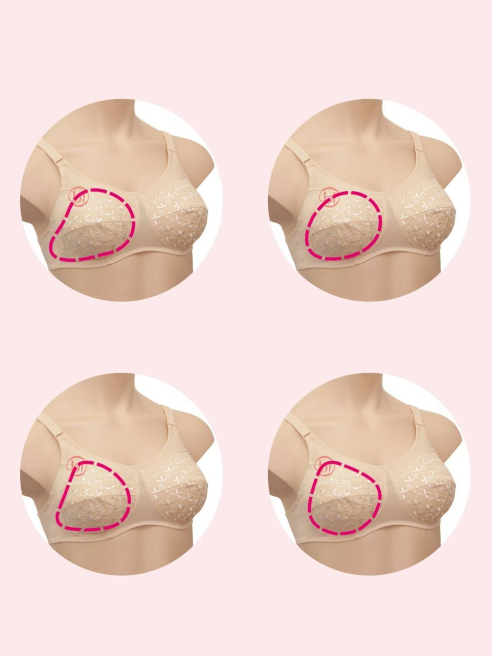 Бюстгальтер для фиксации экзопротеза Valeria ЛФ белый 75