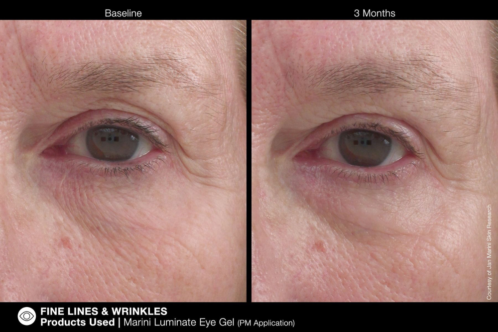 JAN MARINI Luminate Eye Gel Концентрированная сыворотка для кожи вокруг глаз с эффектом сияния против темных кругов и морщин, 15 мл