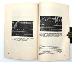 Гедеванишвили Д. М. (АВТОГРАФ) .О парной и раздельной работе больших полушарий головного мозга.1956г