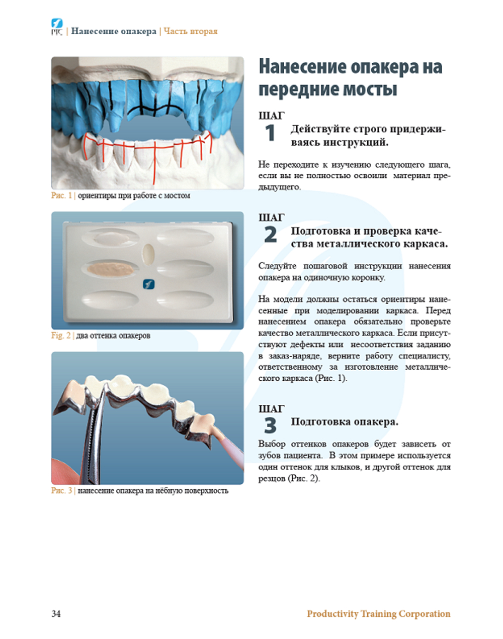 НАНЕСЕНИЕ КЕРАМИЧЕСКОЙ МАССЫ. ПЕРЕДНИЕ И БОКОВЫЕ РЕСТАВРАЦИИ.