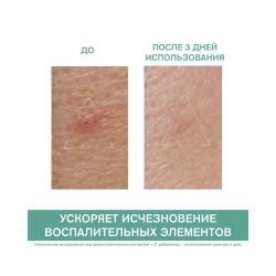 Uriage Hyseac SOS Paste Паста SOS - Локальный уход, 15 г