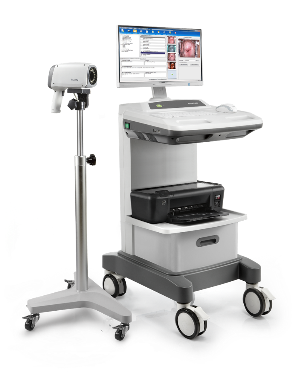 Видеокольпоскоп Edan C6 и Edan C6A