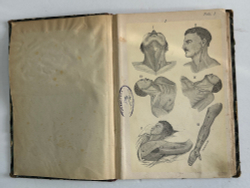 Пирогов Н. Атлас "Анатомия артериальных стволов и фиброзных фасций", 1837г. Дерпт, 54 л. цв. таб.