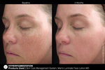 JAN MARINI SKIN CARE MANAGEMENT SYSTEM (NORMAL-COMBO) SPF33