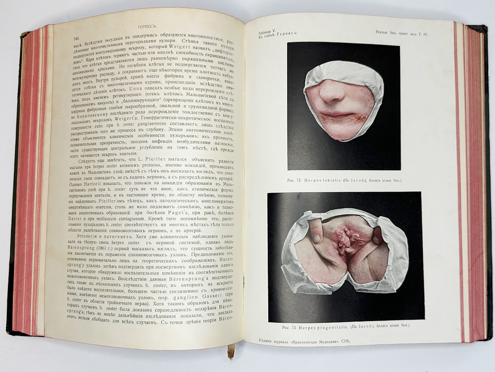 Eulenburg A., проф. Эйленбург А  Реальная энциклопедия практической медицины в XVII томах. 1909-1915