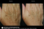 JAN MARINI RENU CORRECTIVE HAND COMPLEX Антивозрастной корректирующий крем для рук