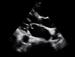 Аппарат УЗИ SIUI Apogee 5500