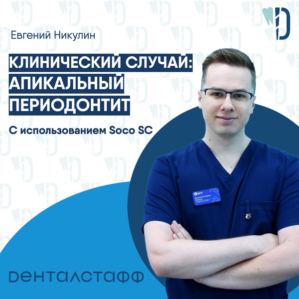 Клинический случай: Апикальный периодонтит от Е. Никулина