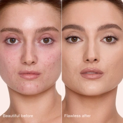 Charlotte Tilbury Airbrush Flawless Concealer with Hyaluronic Acid - 5 Medium