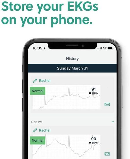 Аппарат ЭКГ AliveCor