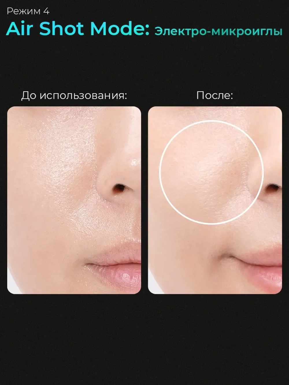 Medicube Микротоковый аппарат для лица 6-в-1 AGE-R Booster Pro Pink